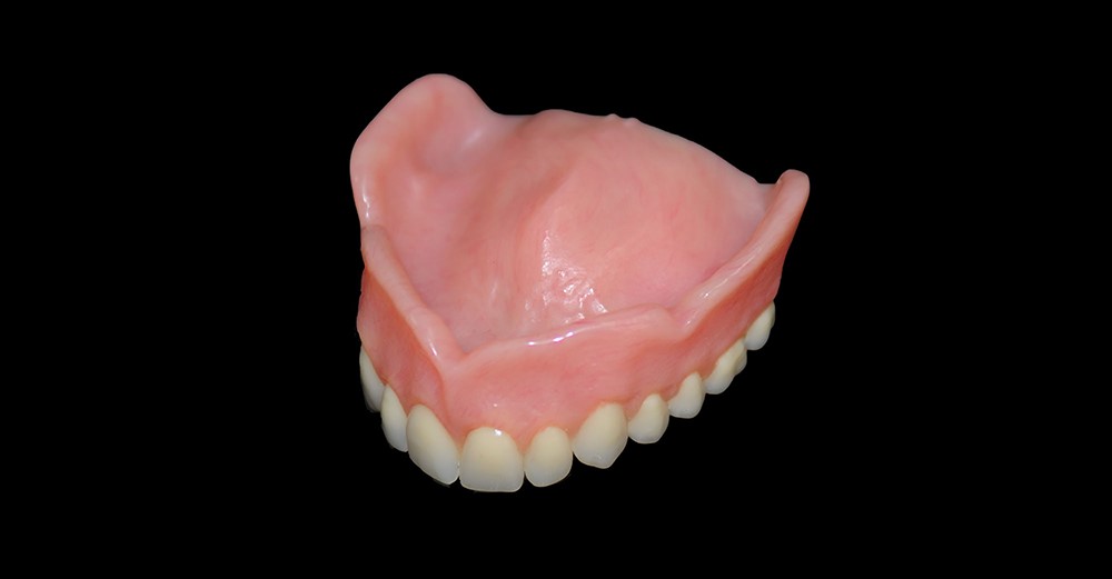 Veneers Vs Dentures Wilton ME 4294